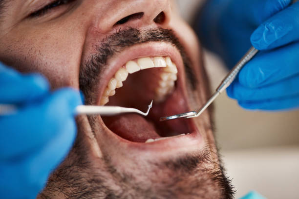 Best Dental Abscess Treatment in Erma, NJ