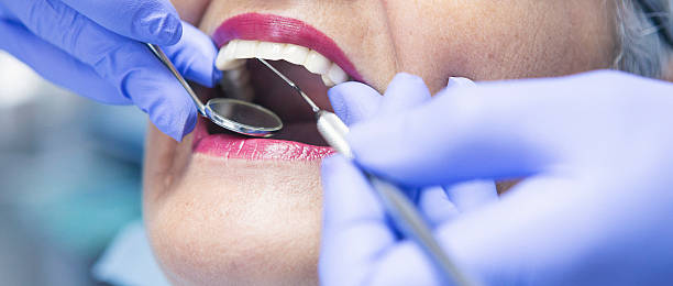 Best Knocked-Out Tooth (Avulsed Tooth) Treatment in Erma, NJ
